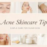 5 Essential Tips on Acne Skincare for Clear and Balanced Skin