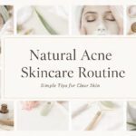 7 Natural Acne Skincare Routine Tips for Clear and Healthy Skin